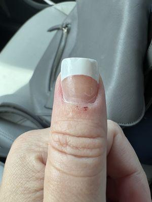 Bumpy nail and burn from sharp buffer