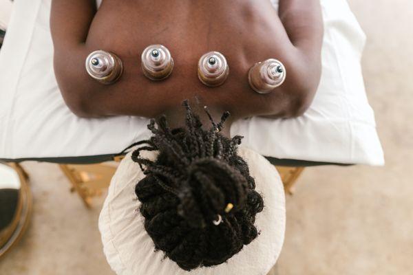 Cupping is like massage but instead of using positive pressure (pushing in), it uses negative pressure (pulling up).