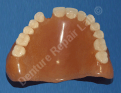 Missing tooth on upper denture