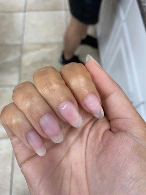 The nail tech drilled into my nail while drilling off my shellac, while also thinning them.