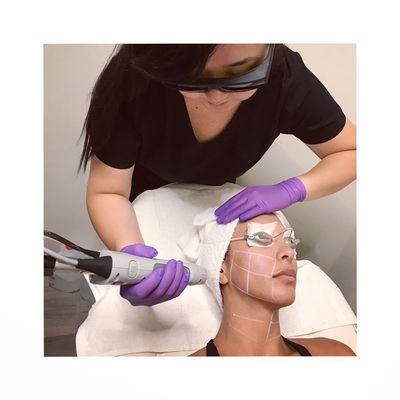 Laser treatments available at Javan!