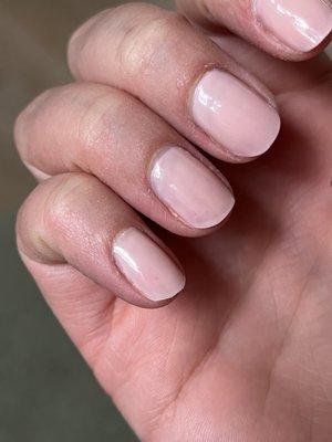 Streaky thin gel application