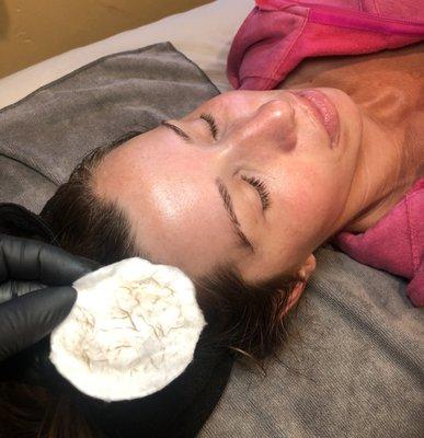 Dermaplane Facial