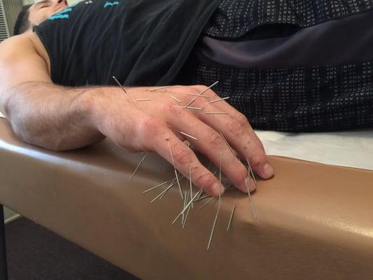 Pasadena Acupuncture Clinic