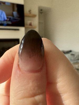 A small mistake in the nail of the thumb.