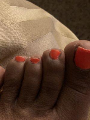 Toenails look chewed off and painted very sloppy