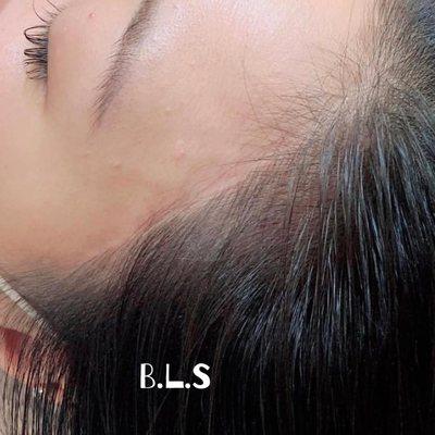 Hairlines Microblading