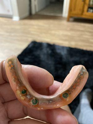 Lower implant I paid extra for is garbage and extremely low quality. Just look at this terrible craftsmanship!!!! Would You accept this???