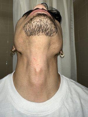 Um even shave and cut on neck