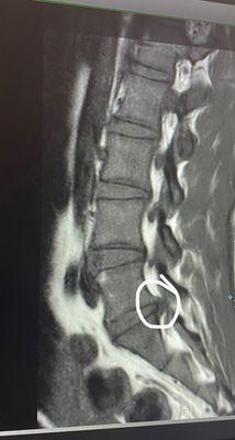 Electrodiagnosis and Musculoskeletal Associates of Puget Sound