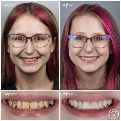 Every patient has their unique journey to a new smile.