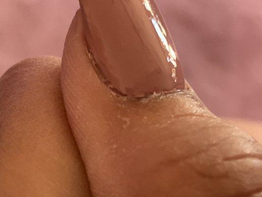 Gaps on my nail