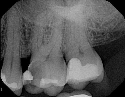 Javidan Endodontics