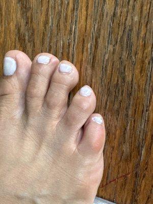 Terrible pedicure