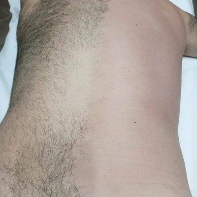 Male back waxing