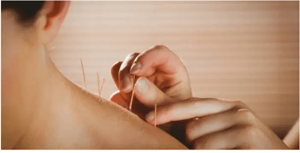 Gotham Holistic Acupuncture and Integrative Health