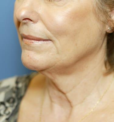 Cascade Facial Surgery and Aesthetics