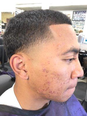 Skin taper