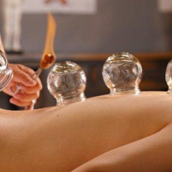 Cupping massage increasing circulation, promoting healing and reduced pain .