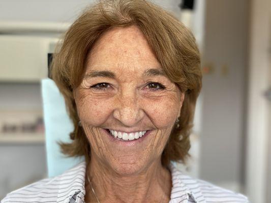 After Procedure-Beautifull Smile