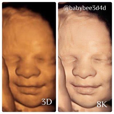 Post Processing 8K image retouch for a realistic image of baby