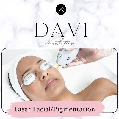 Laser photo facial!