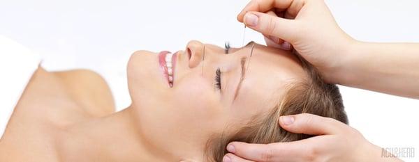 The patient receives acupuncture (facial rejuvenation)