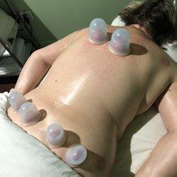 Muscle Detox with Cupping Therapy