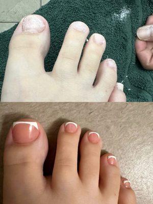 Acrylic Gel Pedicure