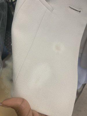 Literal bleach stains, which weren't there when I dropped them off. Turned my white blazer to beige . LMAO