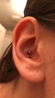 Conch Piercing, (the black stuff is just Ink not blood)