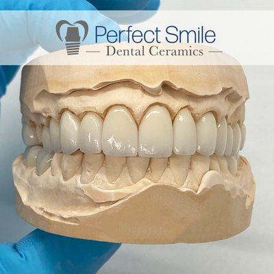 Emax veneers and crowns