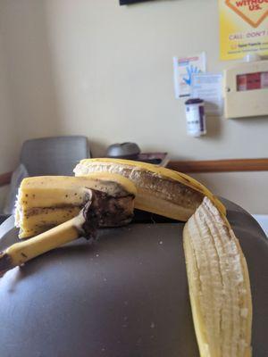 Here a "fresh" banana they brought me to eat. Complete with fruit rot and teeny maggots.