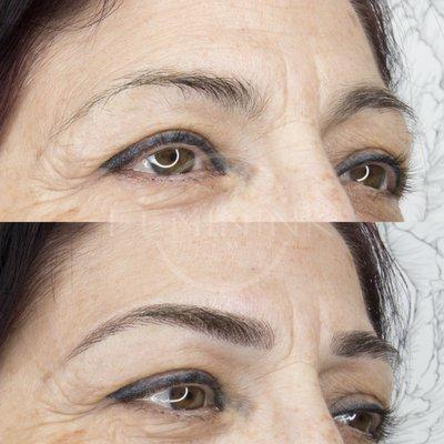 Microblading