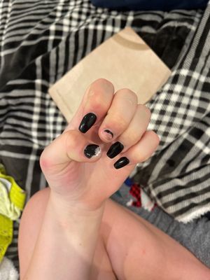 Broken nails