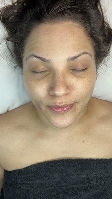 Basic facial with exfoliation after picture