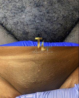 Brazilian Wax