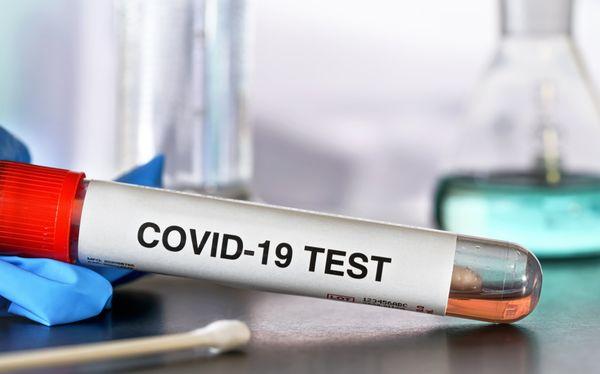 Rapid COVID-19 Testing  - RT-PCR  - Molecular, NAAT and Lamp  - Rapid Antigen  - Antibody