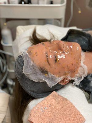 Hydrojelly Facemasks during a Hydrodermabrasion skin treatment!