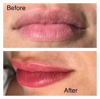 Lip Enhancement by Jeannie