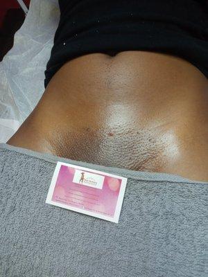 After photo of a Full Brazilian wax and Vajacial