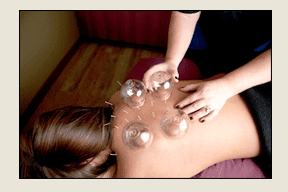 The expert hands of Dr. Kim Kesner, acupuncture and cupping available