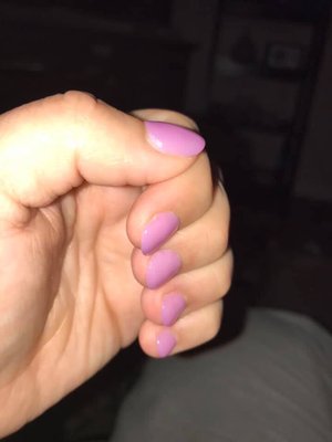 Poorly filed nail and over filed spot on index finger