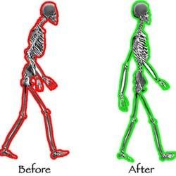 Improve your Posture Reduce your Pain.
 Providing postural alignment therapy through a variety of corrective based exercise techniques.