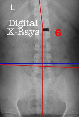 We offer digital X-Rays in the clinic!