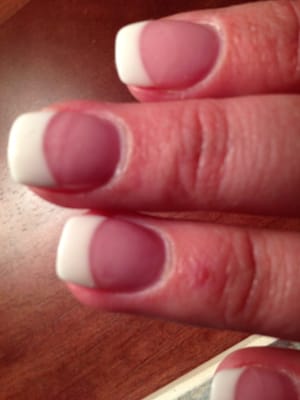 Cuts on my fingers and the line on my nails on how far they had 2 file to fix the mistake I was still charged for! Horrible!!!!