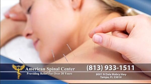 Acupuncture Treatment at American Spinal center.