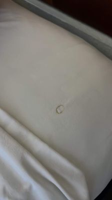 Cigarette burn hole in sheets