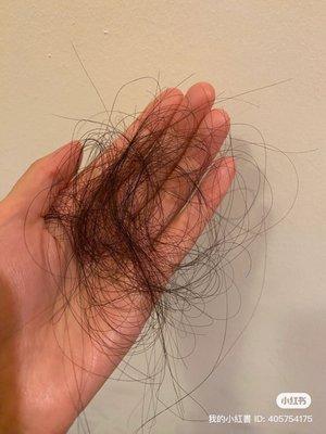 The amount of hair loss just from one comb. After hair treatment.