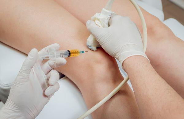 Regenerative injection into the knee for osteoarthritis